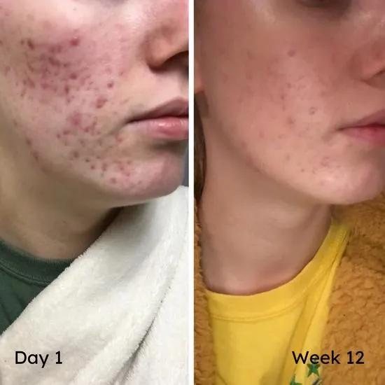 Botanycl SkinClear Elixir