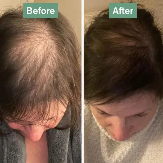 Dr Vegan Hair Saviour Capsules 60 Capsules