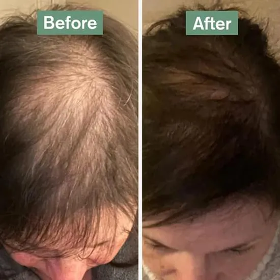 Dr Vegan Hair Saviour Capsules 60 Capsules