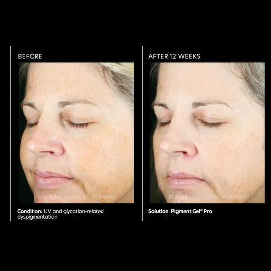 PCA SKIN Pigment Gel Pro 29ml