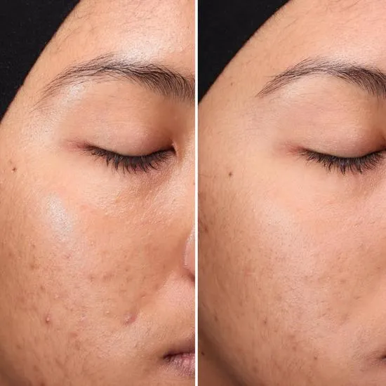 Medik8 Press & Clear Refill: 150ml