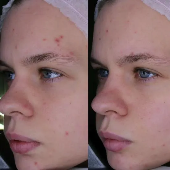 AMELIORATE Balancing Facial Moisturiser 30ml