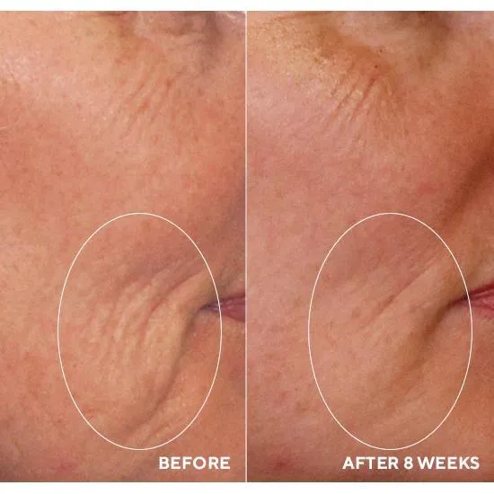 HydroPeptide Daily Drench 30ml