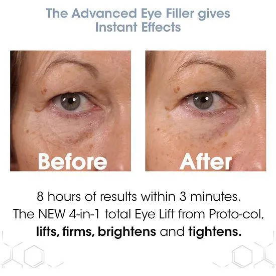 Proto-col The Eye Lift 15ml
