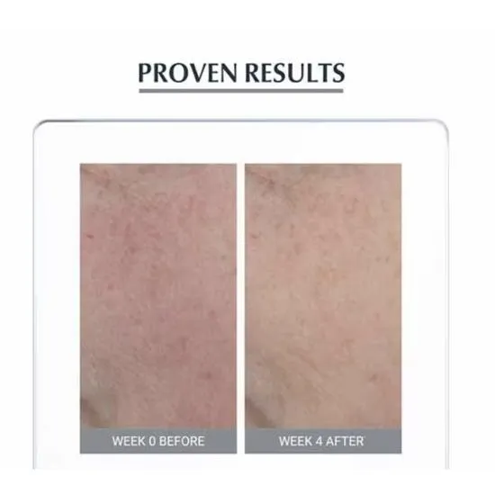 Eucerin Anti Redness Concealing Day Cream 50ml