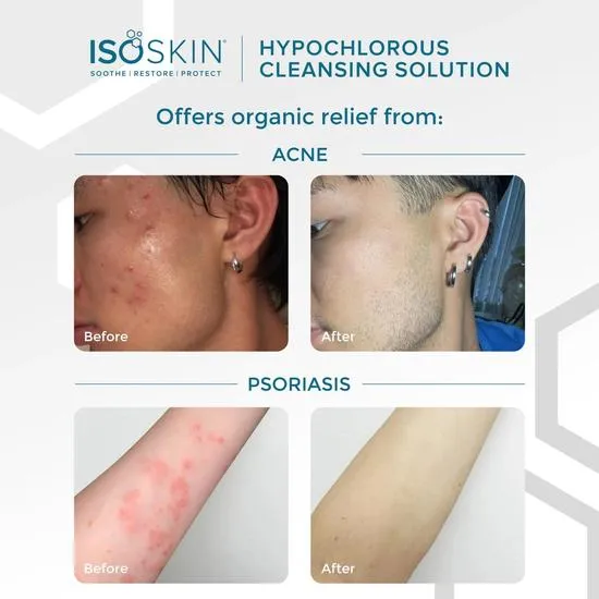 ISOCLEAN ISOSKIN Hypochlorous Spray 275ml