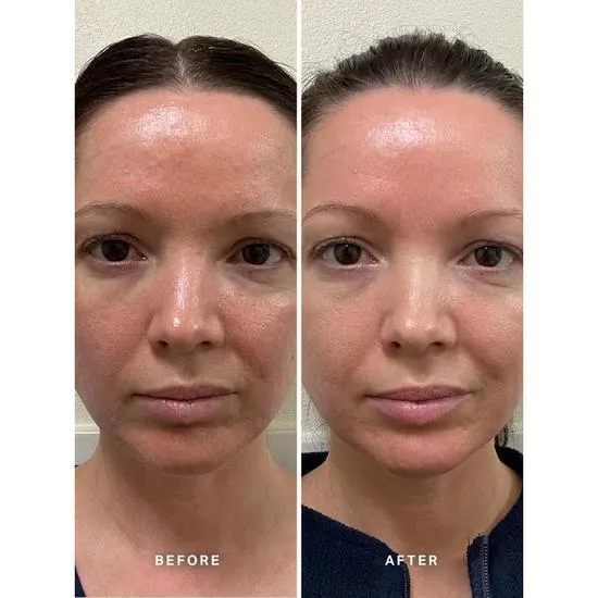 Alpha-H Vitamin B Serum With 5% Niacinamide 10ml