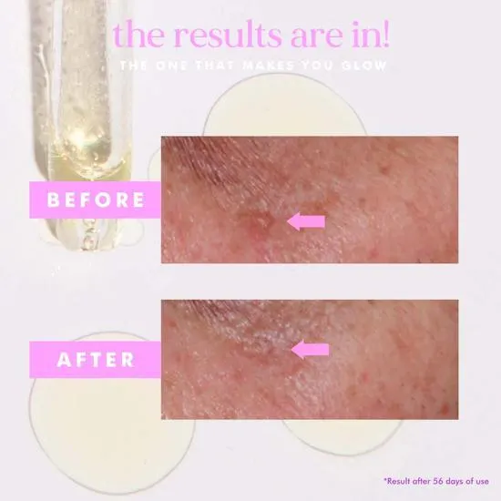 Hello Sunday The One That Makes You Glow Dark Spot Serum SPF 40