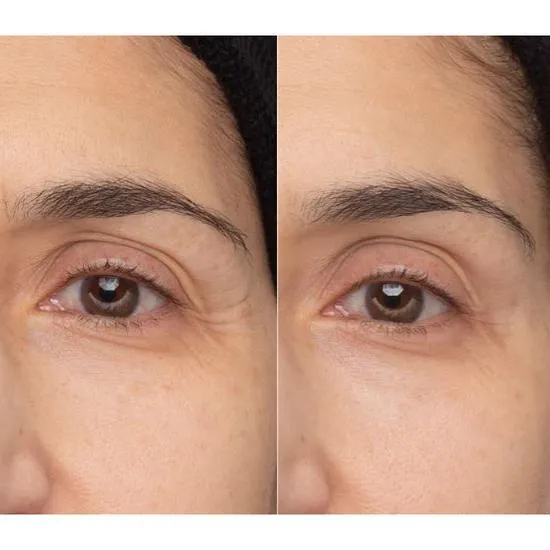 HydroPeptide Retinol Eye Renewal Balm 15ml