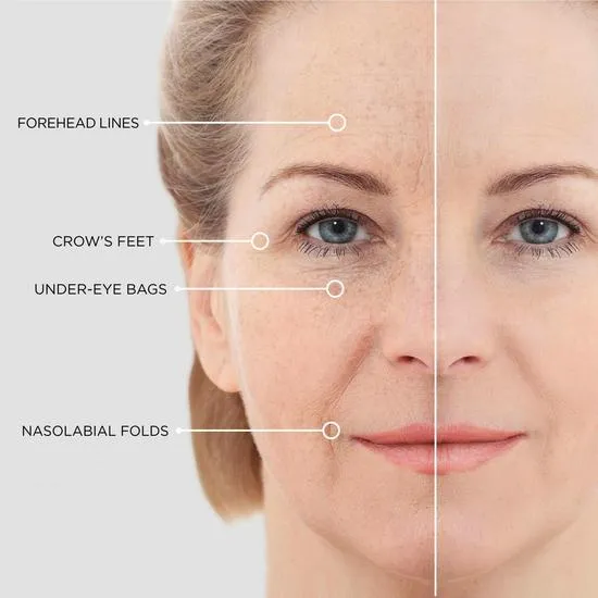 BEAUTICAL Instant Lifting Serum