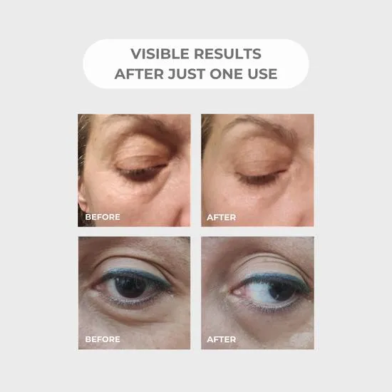 BEAUTICAL Instant Lifting Serum