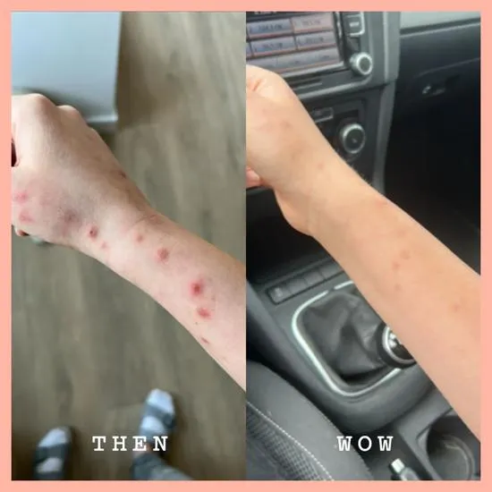 Frank Body Squeaky Cheeks