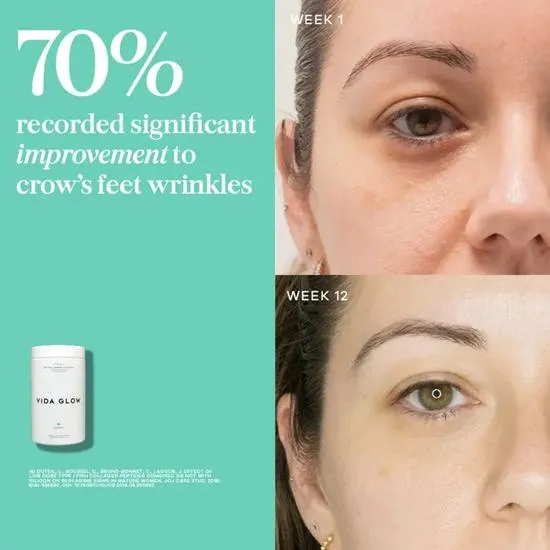 Vida Glow Natural Marine Collagen Supplement Caddy