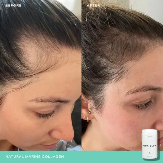 Vida Glow Natural Marine Collagen Supplement Caddy