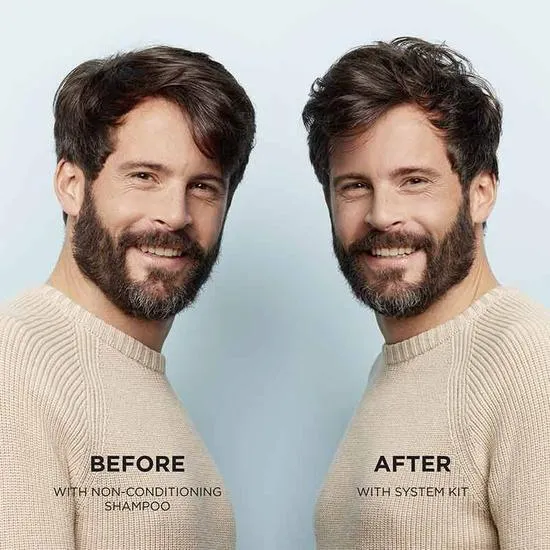 Nioxin System 1 Scalp Therapy Conditioner 300ml