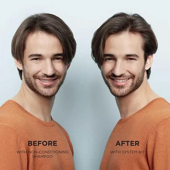 Nioxin System 1 Scalp Therapy Conditioner 300ml