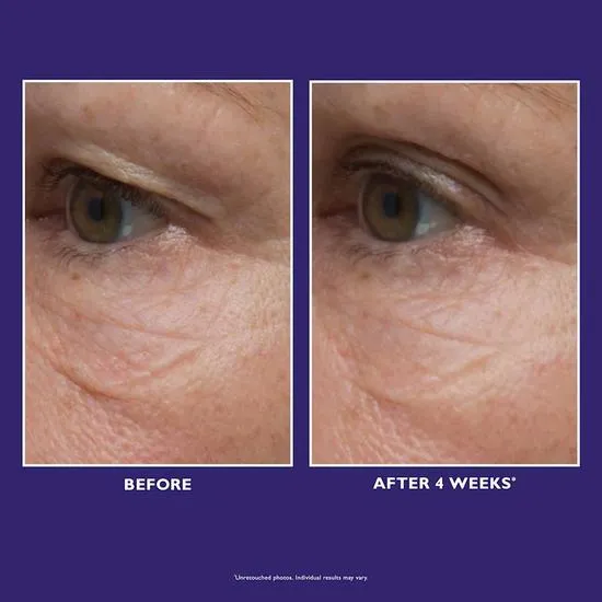 Peter Thomas Roth Ultimate Solution 5 Multitasking Eye Cream