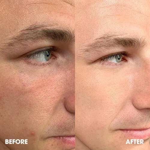 Shakeup Cosmetics Let's Face It BB Tinted Moisturiser Bronze