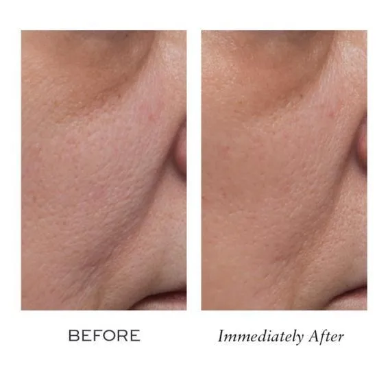 ELEMIS Peptide4 Thousand Flower Mask 75ml