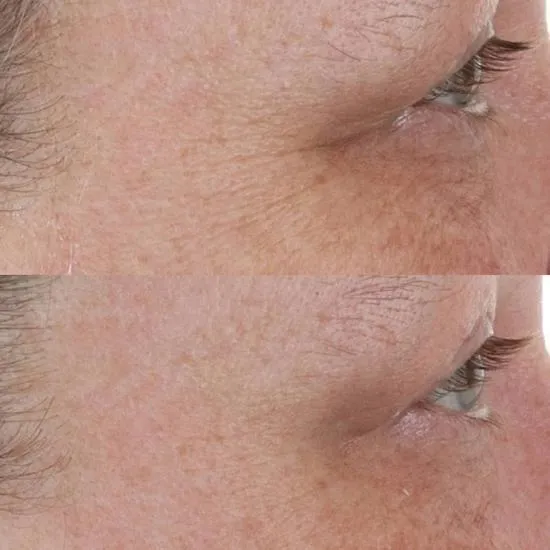 Perricone MD High Potency Retinol Recovery Overnight Moisturiser