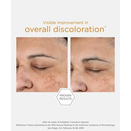 NeoStrata Pigment Controller 50ml