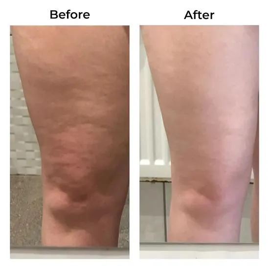 Skinade Targeted Solutions Cellulite