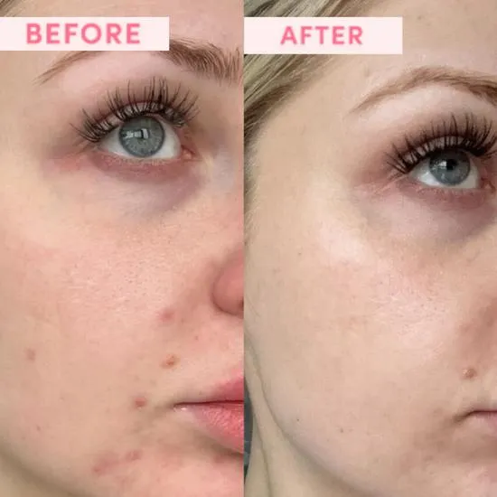 Sand & Sky Resurfacing Face Mask 80g