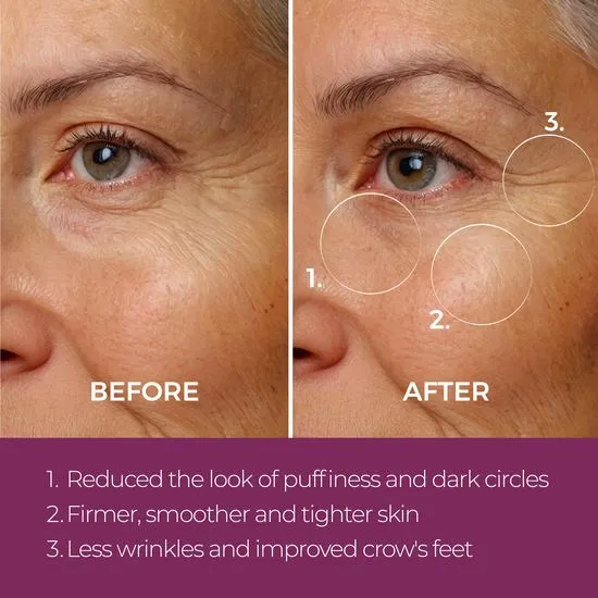 blinc Eye Repair Peptide Complex