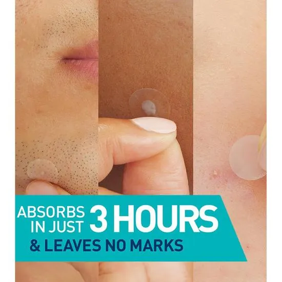CeraVe Blemish Barrier Patches