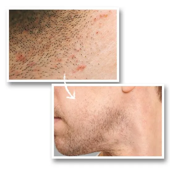 Shakeup Cosmetics Calm As You Are Post Shave Lotion