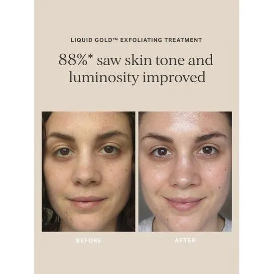 Alpha-H Liquid Gold To Go Gift Set