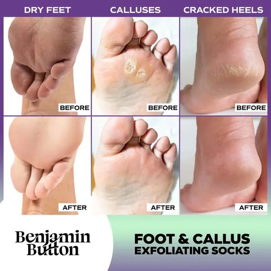 Benjamin Button Advanced Exfoliating Foot Mask