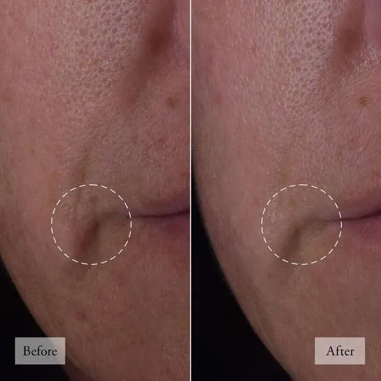 Philosophy Dose Of Wisdom Bouncy Skin Reactivating Serum 30ml