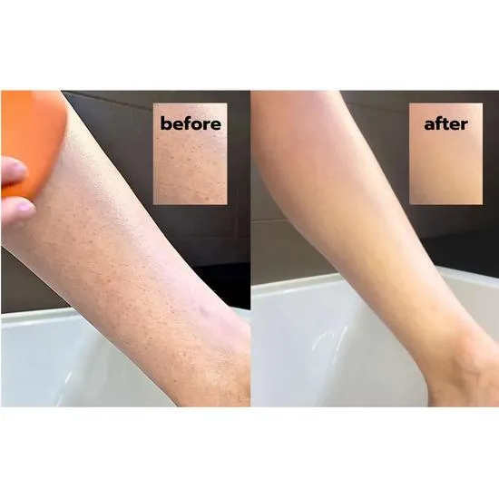 Answr Exfoliating Hair Removal Drop