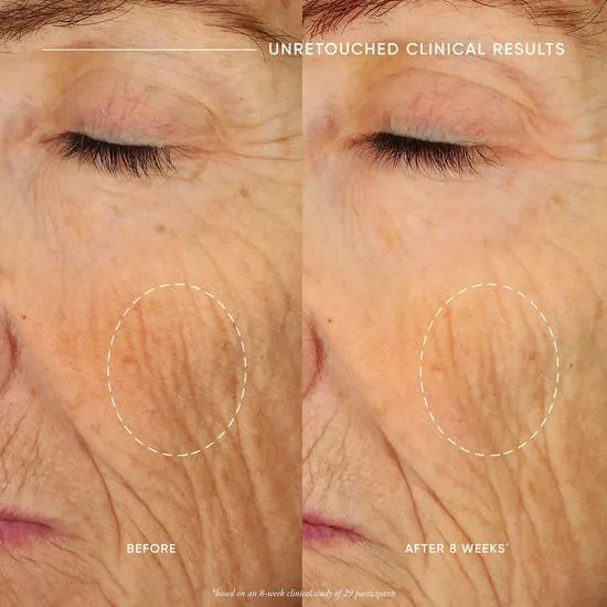 Philosophy Ultimate Miracle Worker Nourish & Rejuvenate Face & Neck Cream 60ml