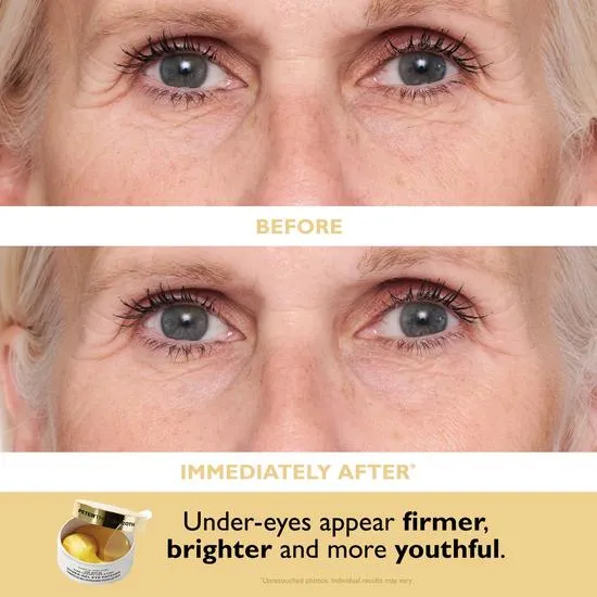 Peter Thomas Roth 24k Gold 2-Piece Kit