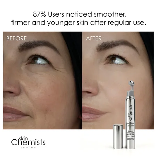 skinChemists Caviar Advanced Anti-Ageing Eye Treatment 15ml