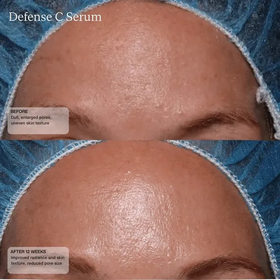Sente Defence C Serum