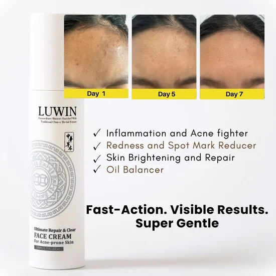 LUWIN Ultimate Repair & Clear Face Cream For Acne-prone Skin 50ml
