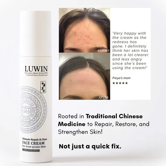 LUWIN Ultimate Repair & Clear Face Cream For Acne-prone Skin 50ml
