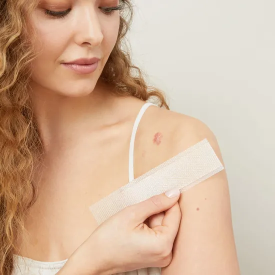 Scar Erase Silicone Scar Removal Sheets