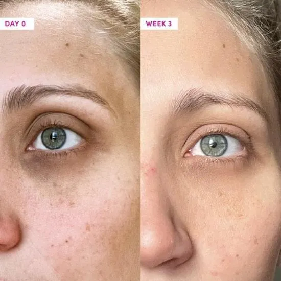 Sand & Sky Anti-Ageing Eye Cream 20g