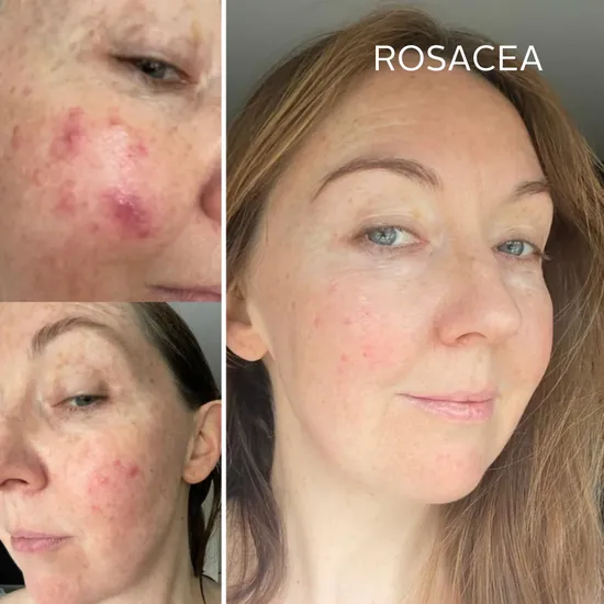 Raven Botanicals Rescue Serum 30ml