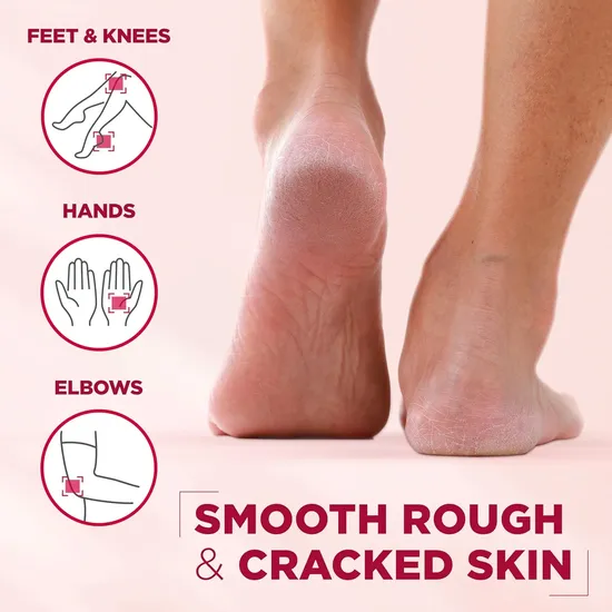 Mixa 10in1 Cica Repair Plus Repairing Ointment 150ml