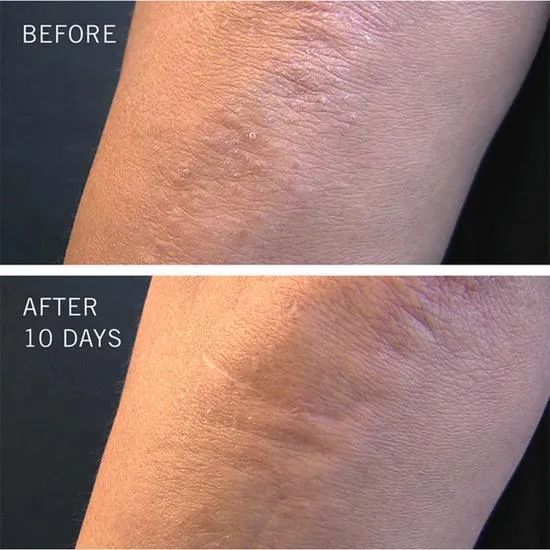 First Aid Beauty KP Bump Eraser Body Scrub With 10% AHA 28g