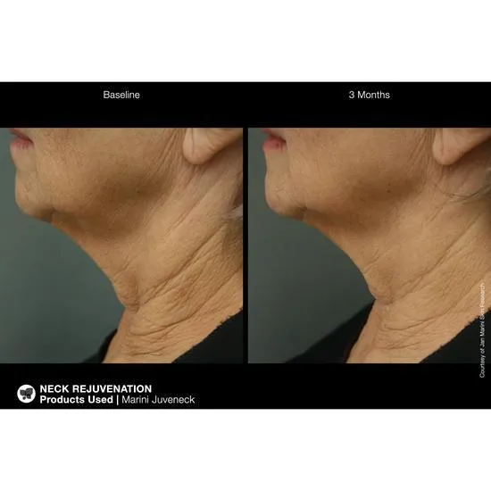 Jan Marini Juveneck Neck Cream 57g