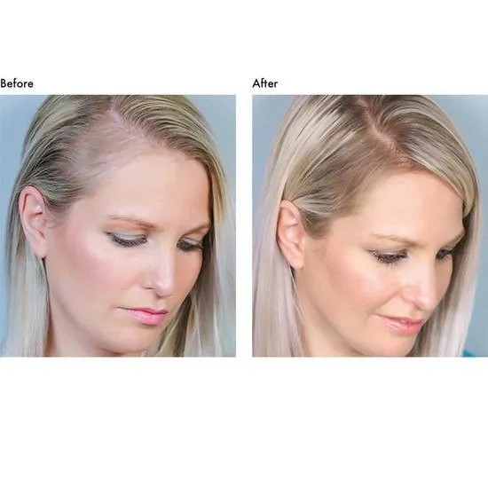 Hair Gain Capsules 60 capsules (1 Month)