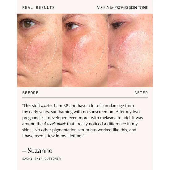 Sachi Skin Triphala Pigmentation Corrector 30ml