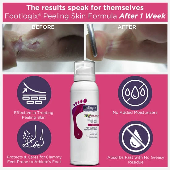 Footlogix Peeling Skin Formula 125ml
