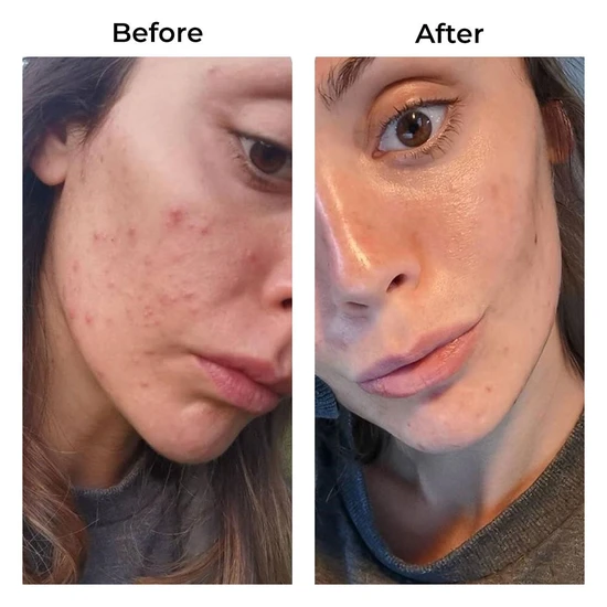 Skinade Targeted Solutions Clear